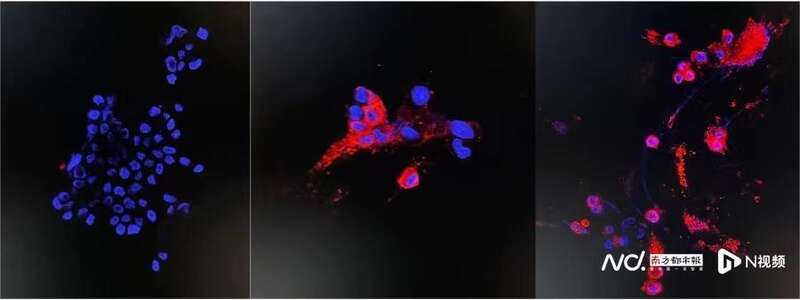 香港大学微生物系团队成功分离及培养奥密克戎毒株，免疫荧光图像检测变种病毒的NP蛋白 ...